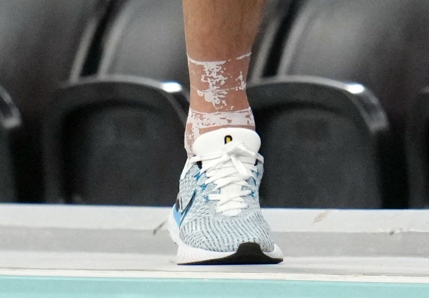 Harry Kane để lộ mắt cá chân bất thường